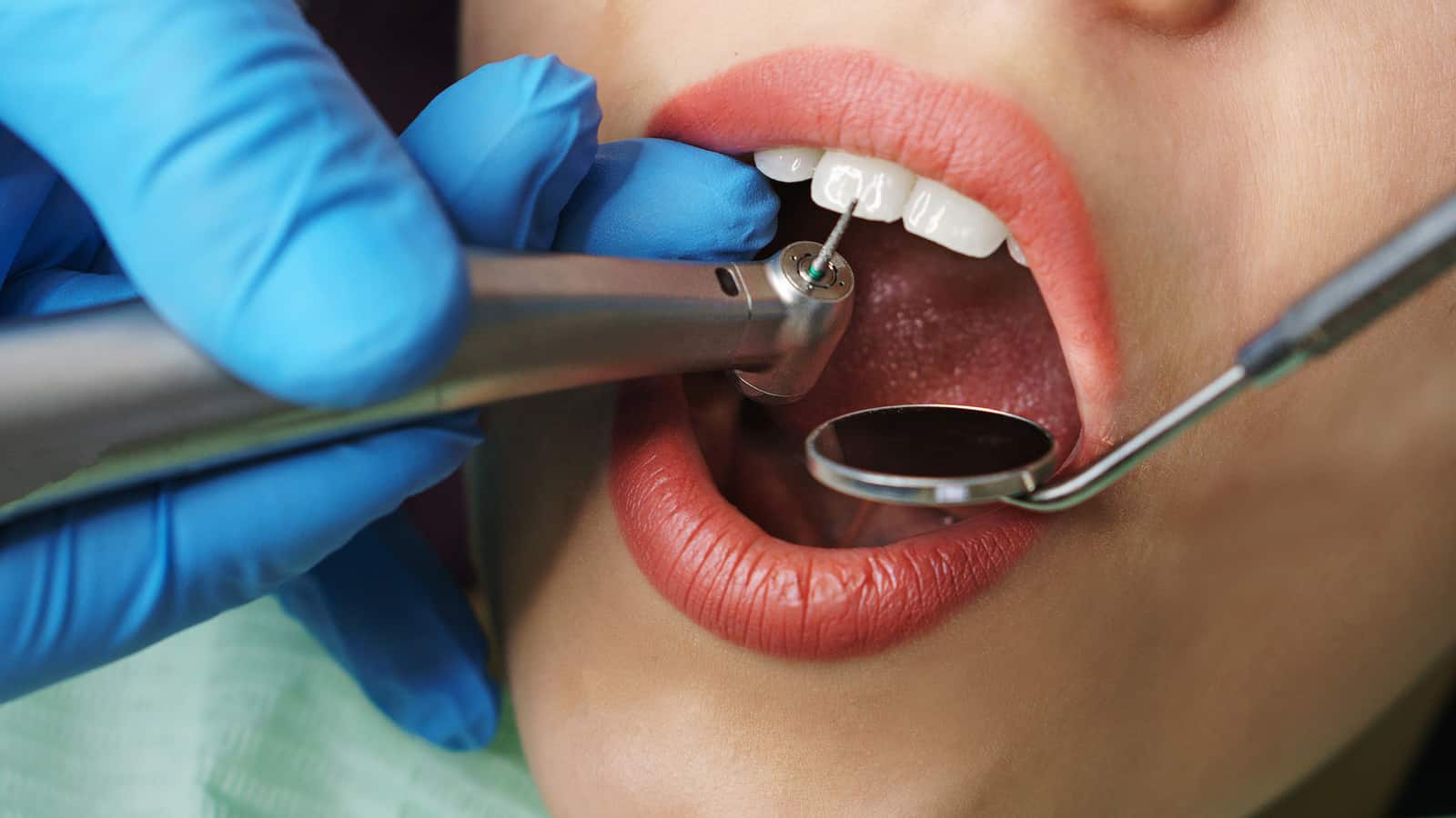 TeethSaver Apicectomy